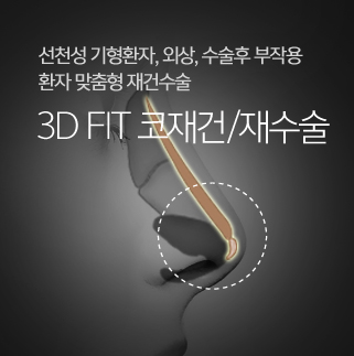 3D FIT 코재건/재수술